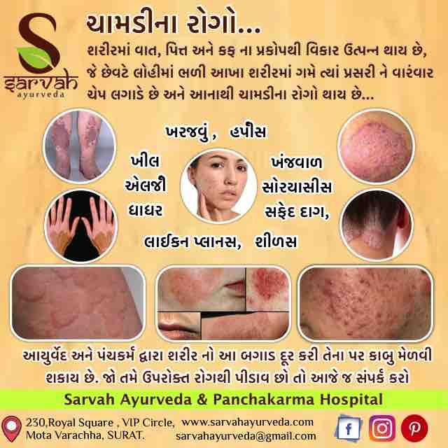 Read more for Ayurvedic Treatment of Anaemia Disease
